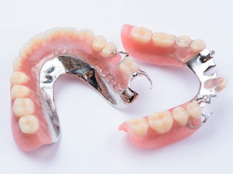 Les-protheses-partielles-Dentistes-Shawinigan