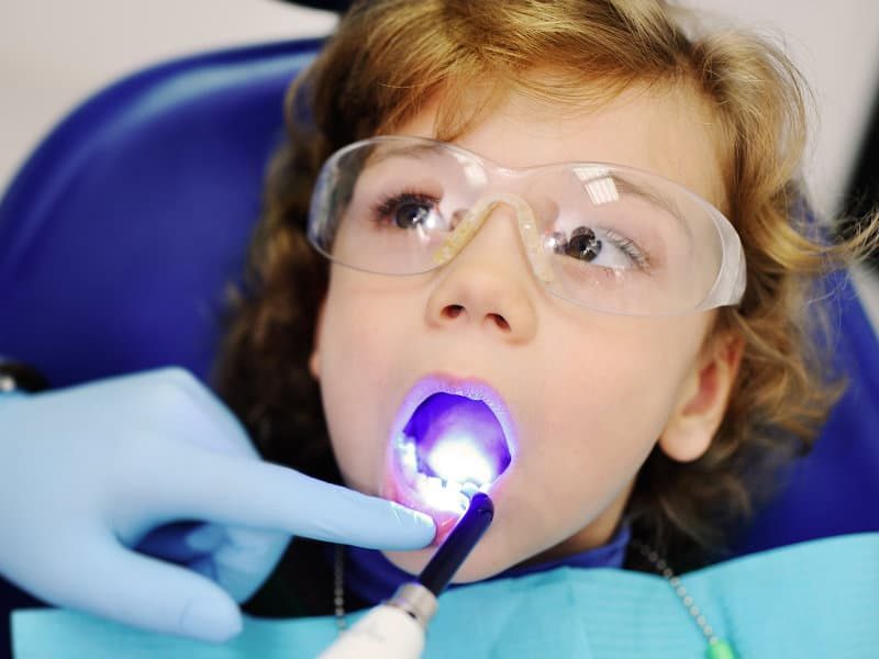 Scellant-Dentaire-Dentistes-Shawinigan