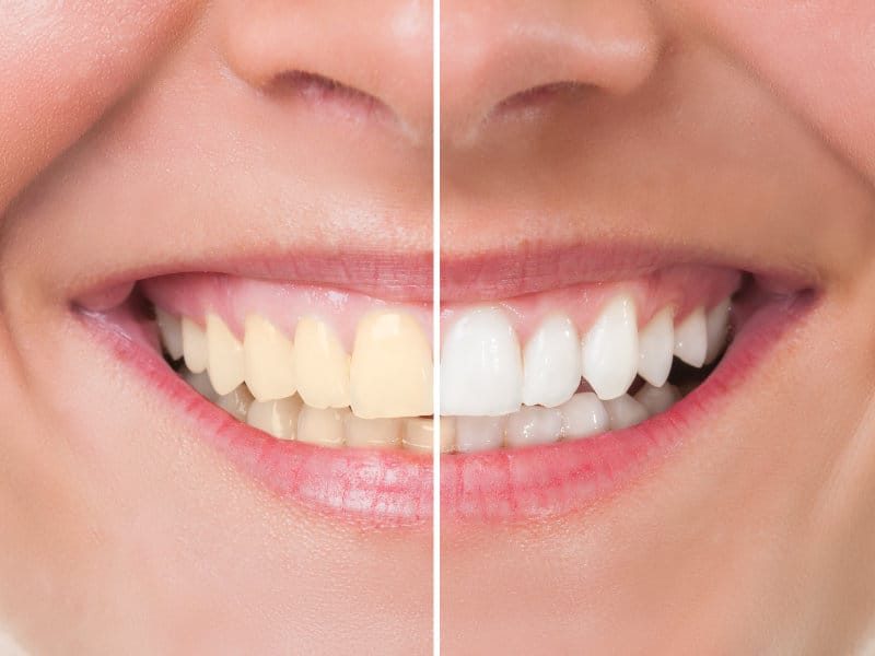 Dentisterie Esthétique et Orthodontie