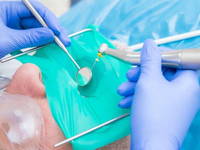 Endodontie-Dentistes-Shawinigan