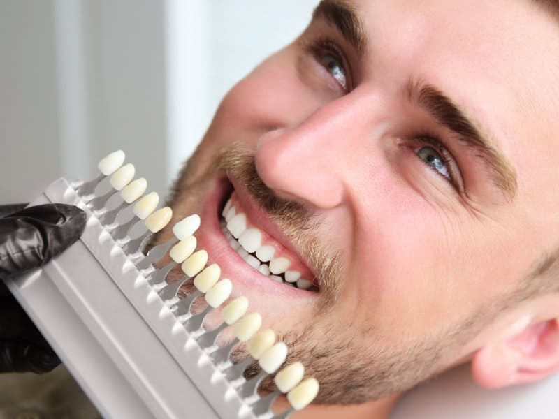 Facettes-Dentistes-Shawinigan