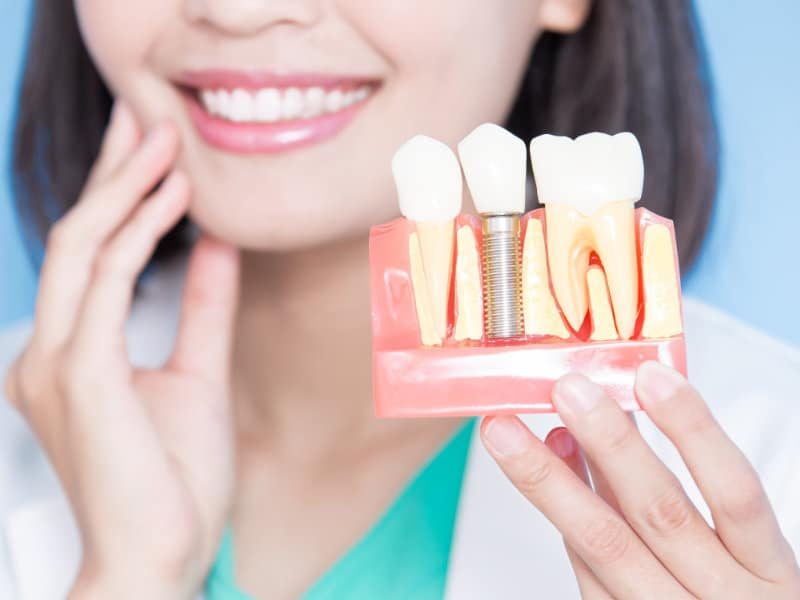 Les-Implants-Dentistes-Shawinigan