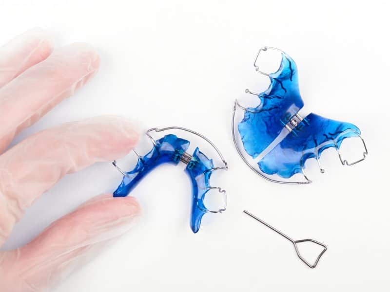 Orthopedie-Dento-faciale-Dentistes-Shawinigan